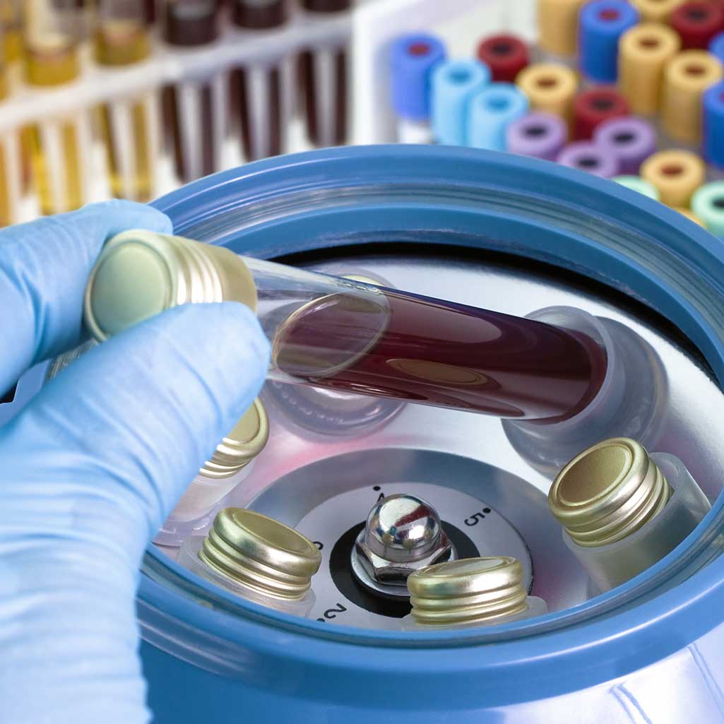 Biotech laboratory centrifuge under calibration — part of the same field-service program that handles BSC and cleanroom recertification