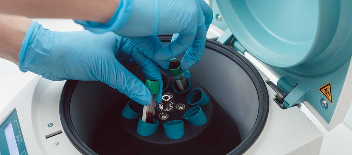Gloved hands loading sample tubes into a benchtop centrifuge — the centrifuge program work that anchors clinical and biotech labs